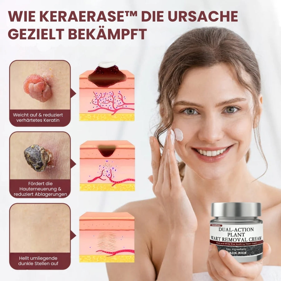 KeraErase™ | Pflanzliche Warzenentfernungscreme mit Doppelwirkung