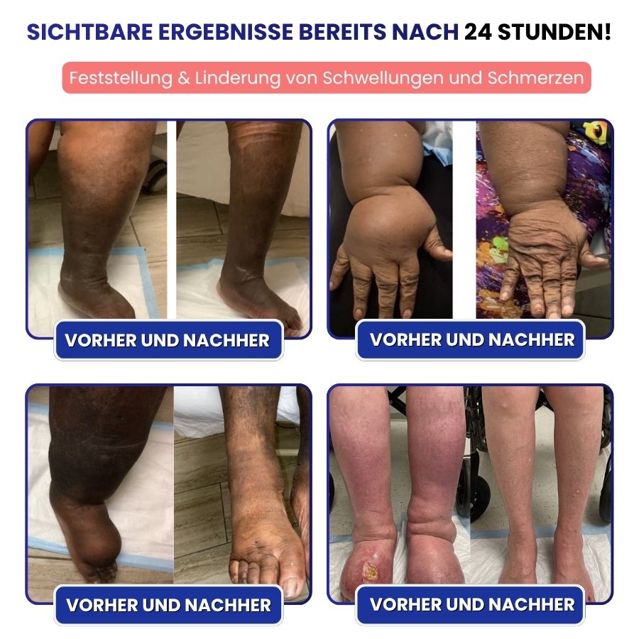 VitaLegs™ | Anti-Ödem-Creme