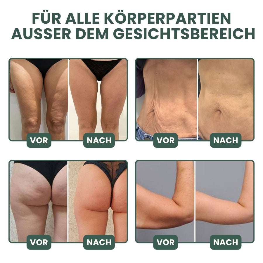 SkinLift™ | Kollagen-Lifting Körperöl