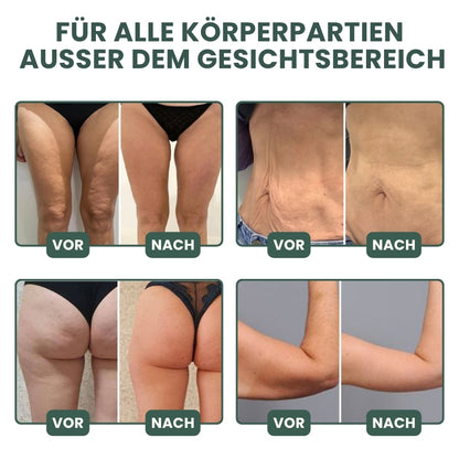 SkinLift™ | Kollagen-Lifting Körperöl