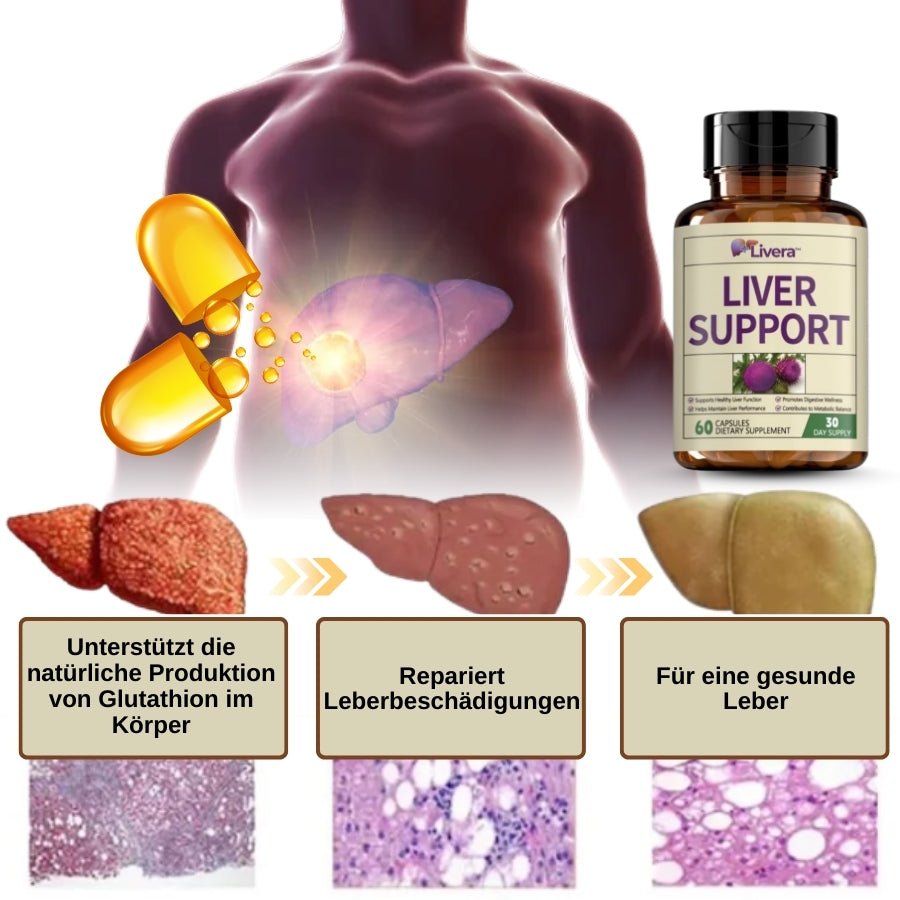 Livera™ | Kräuter-Nahrungsergänzungsmittel für Leberunterstützung