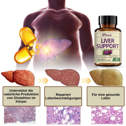 Livera™ | Kräuter-Nahrungsergänzungsmittel für Leberunterstützung