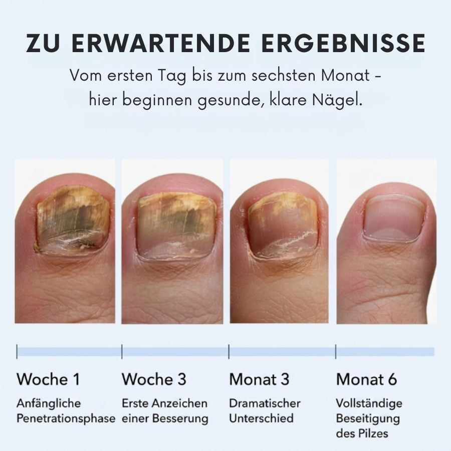 FungiPen™ | Antipilz-Behandlungsstift