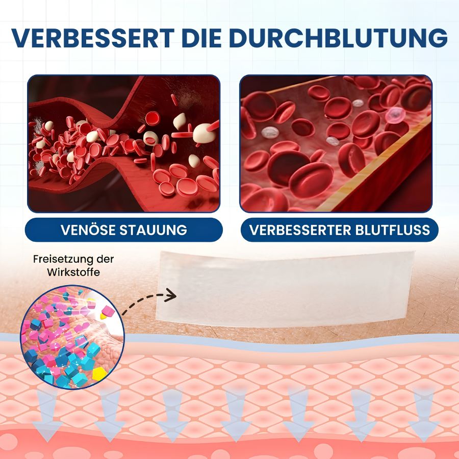Varinyx™ | Microneedling-Pflaster gegen Krampfadern