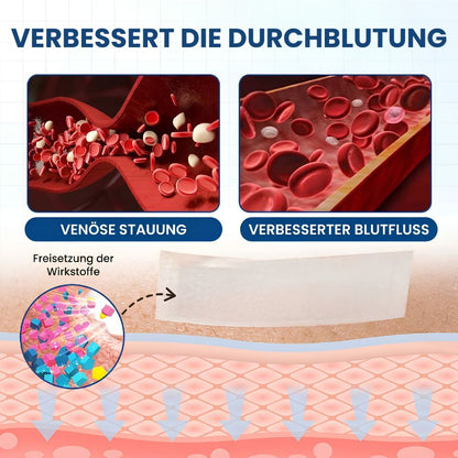Varinyx™ | Microneedling-Pflaster gegen Krampfadern