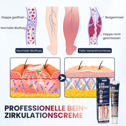 SwelRelief™ | Creme zur Linderung von Beinödemen