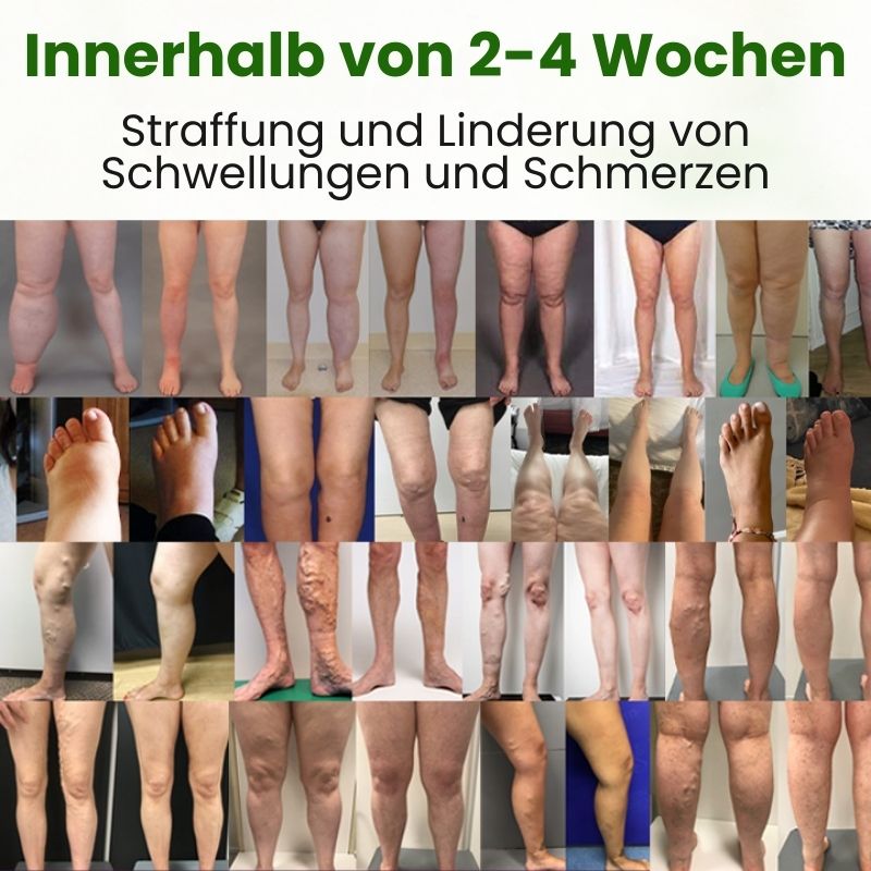 CalmLeg™ | Professionelle Bein-Circulationscreme