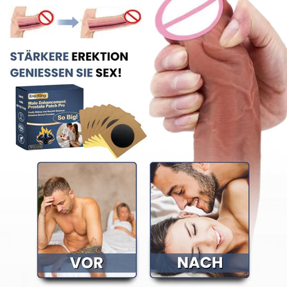ErecKing™ | Männliches Verstärkungs-Erektions-Pflaster Pro