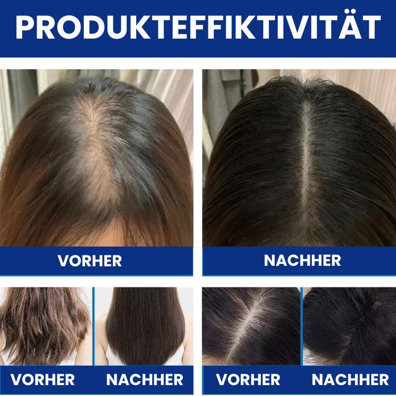 HaarRenew™ | 5 % Minoxidil mit Biotin Haarserum