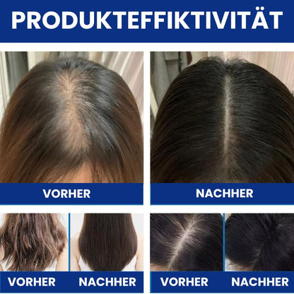 HaarRenew™ | 5 % Minoxidil mit Biotin Haarserum