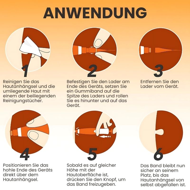 KnötchenFix™ | Hautanhängsel-Entferner Set