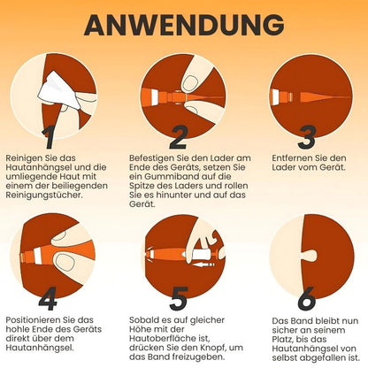 KnötchenFix™ | Hautanhängsel-Entferner Set