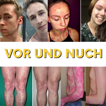 NaturDerm™ | Haut Beruhigende Kräutersalbe