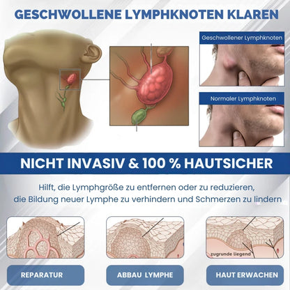SwelEase™ | Kräutercreme zur Ödempflege