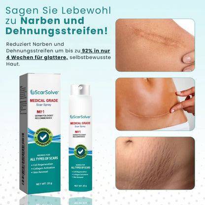 ScarSolve™ | Medizinisches Narbenspray