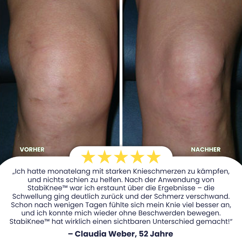 StabiKnee™ | Magnetische Kniebandage