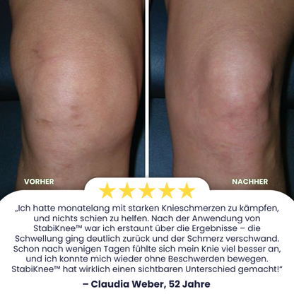 StabiKnee™ | Magnetische Kniebandage