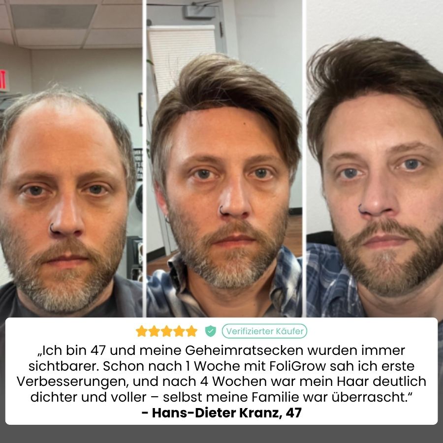 FoliGrow™ | Erlebe echtes Nachwachsen und gewinne in 7 Tagen 92% deines Haarvolumens zurück