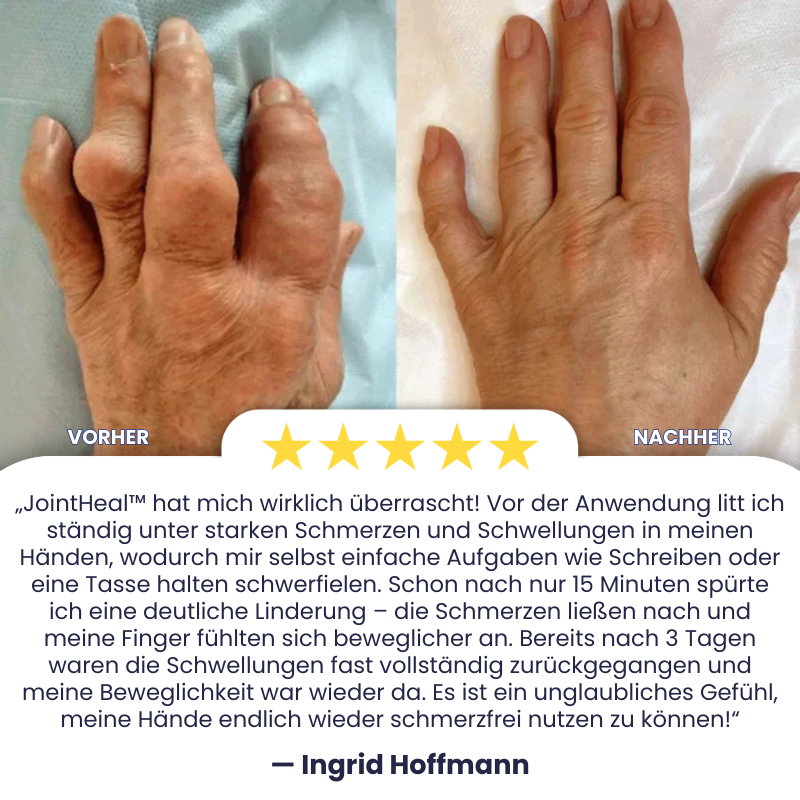 JointHeal™ | Gelenkpflege-Gel-Roller