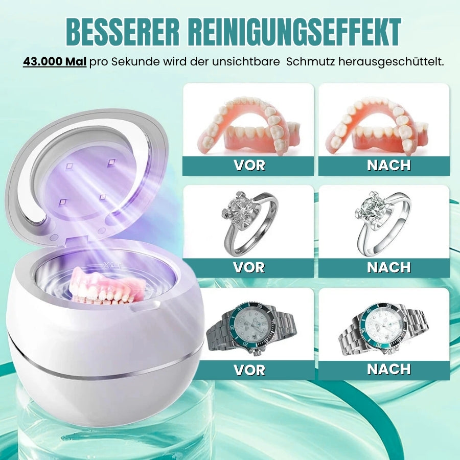 CleanDent™ | Ultraschall-Desinfektionsbox