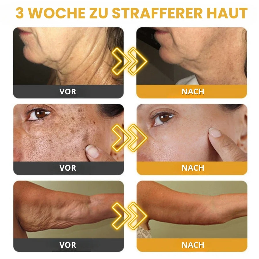 Venomé™ | Botox Faltenstraffende Creme