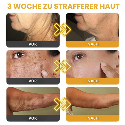 Venomé™ | Botox Faltenstraffende Creme