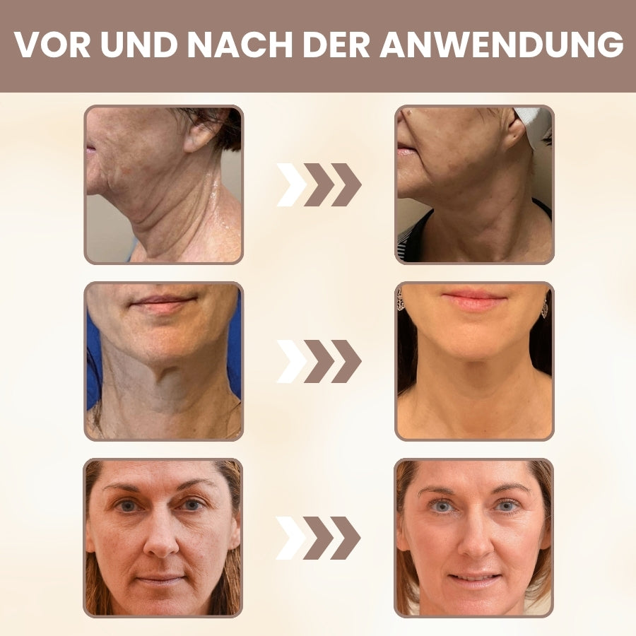 DermaPure™ | 15-Stunden-Lifting für das Gesicht