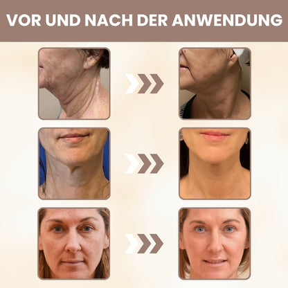 DermaPure™ | 15-Stunden-Lifting für das Gesicht