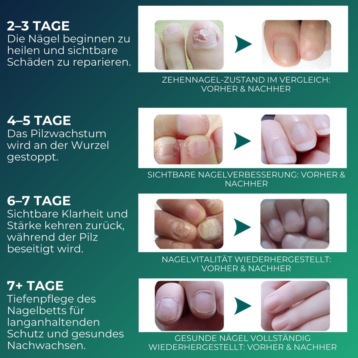 NailHero™ | Nagelpflegestift