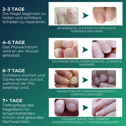 NailHero™ | Nagelpflegestift