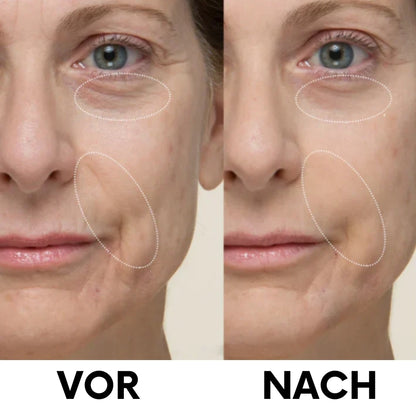 Liftéa™ | Sofort straffende Gesichtscreme