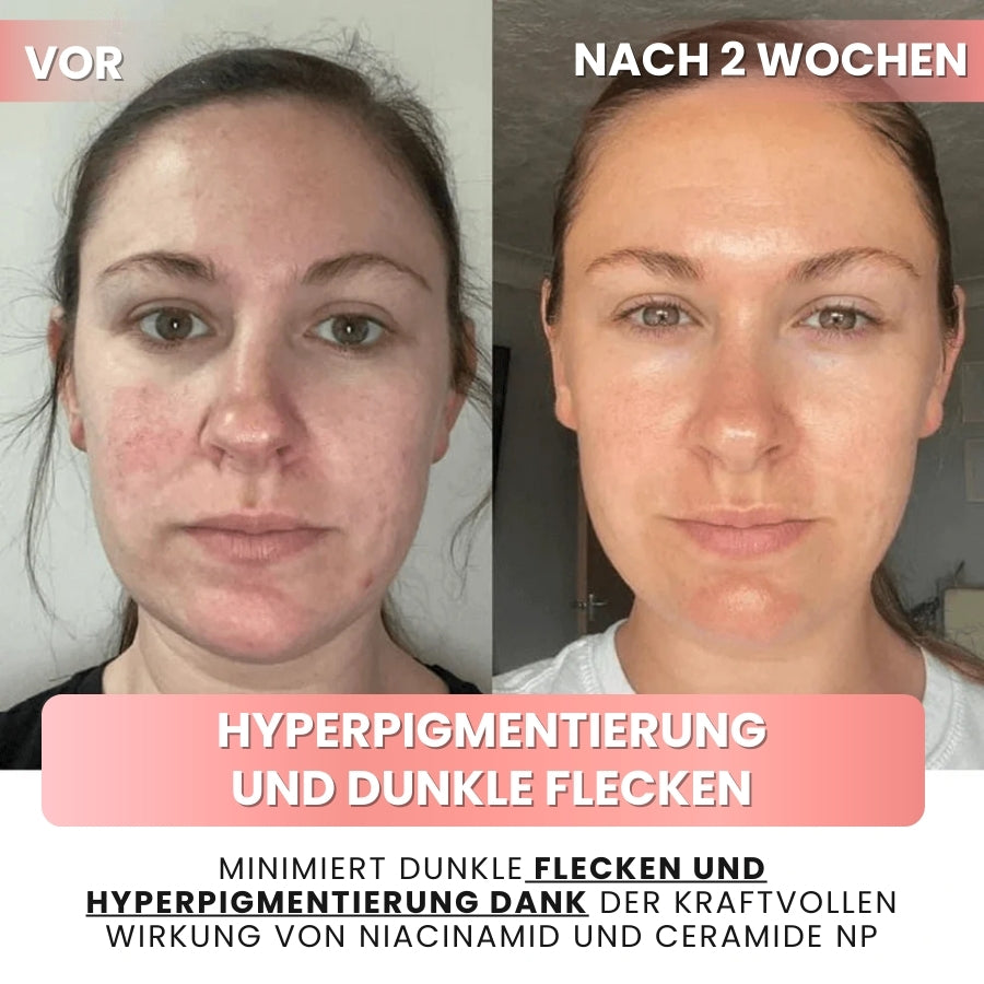 SkynFlow™ | Kollagen- und Niacinamid-Wickelmaske