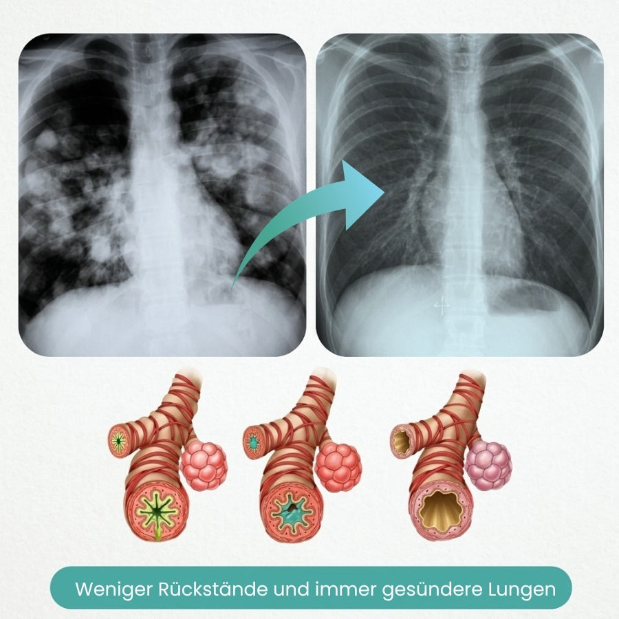 LungWell™ | Multifunktionale Nährstoffe für die Lunge