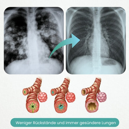 LungWell™ | Multifunktionale Nährstoffe für die Lunge