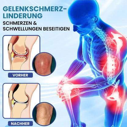 GelenkPro™ | Hyaluron-Creme gegen Gelenkschmerzen