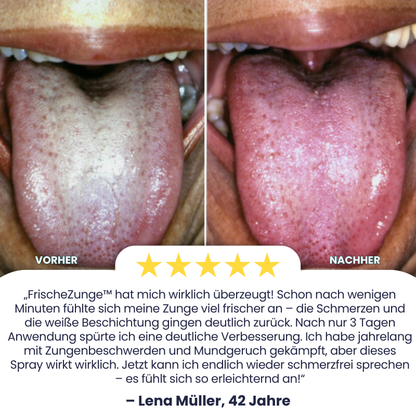 FrischeZunge™ | Zungenreparatur-Spray