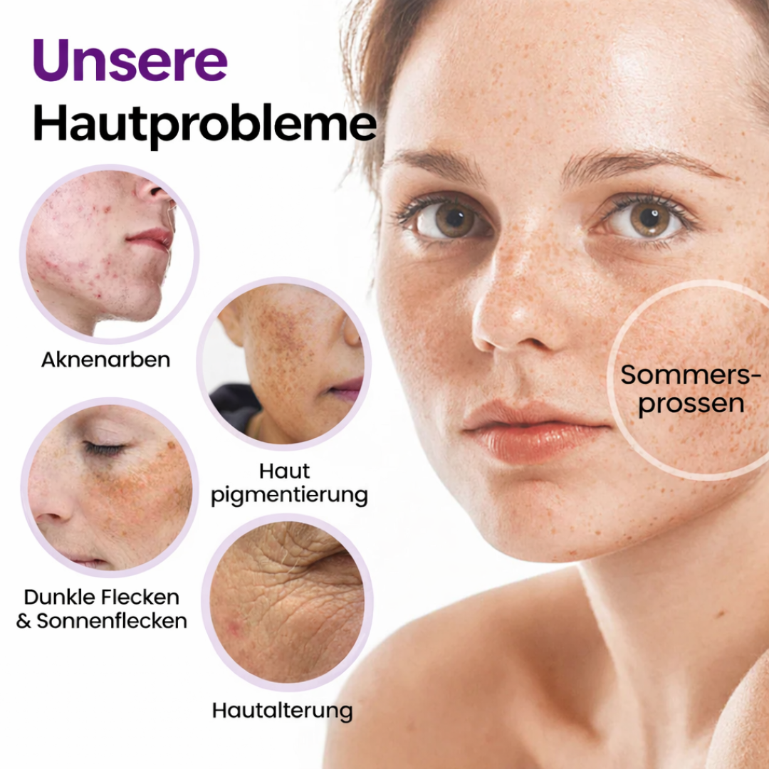 SpotErase™ | Tiefenpflege für das Gesicht