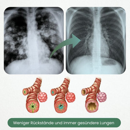 LungFlow™ | Lungenreinigende Kräutertropfen mit Cordyceps-Sinensis-Extrakt