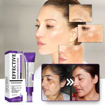 BrillaSkin™ | Fortschrittliche Anti-Hyperpigmentierungscreme