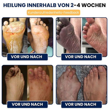 NerviFree™ | Roll-On gegen Nervenschmerzen