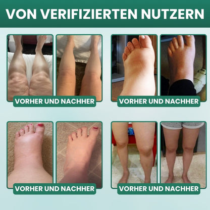 Lymphoria™ | Wellness-Tropfen für die Lymphdrainage