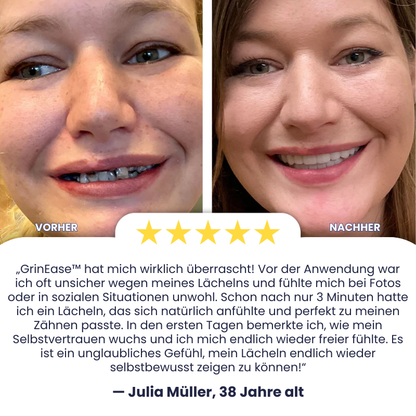 GrinEase™ | Silikon-Relining-Set für Zahnprothesen