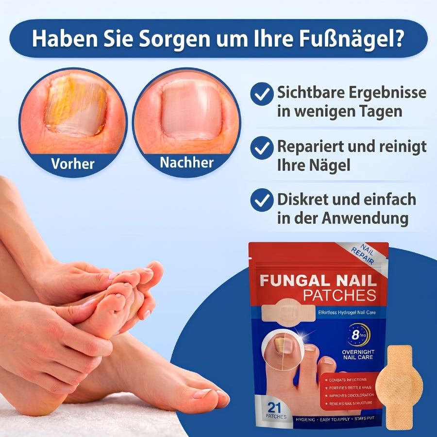 NailRepair™ | Antimykotisches Nagelpflaster