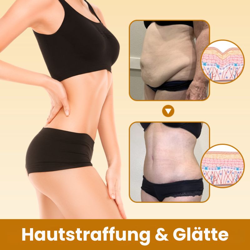 SlimBauch™ | Slimming Massage-Öl