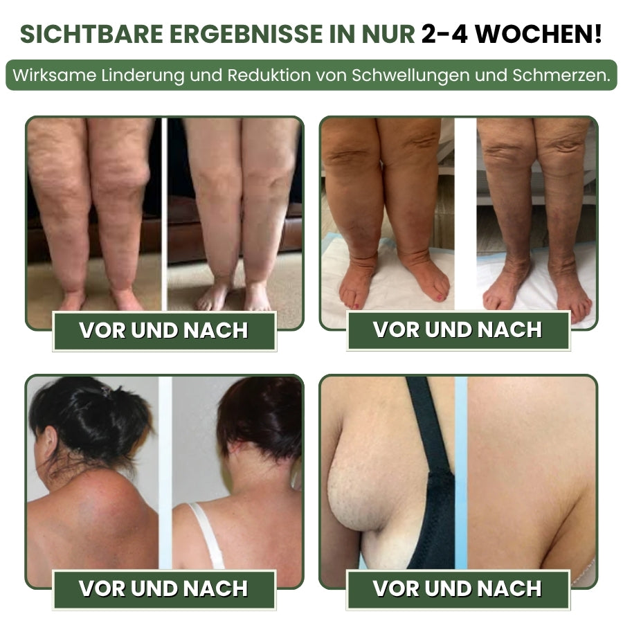 SwellPure™ | Lymphatic Detox Kräutercreme
