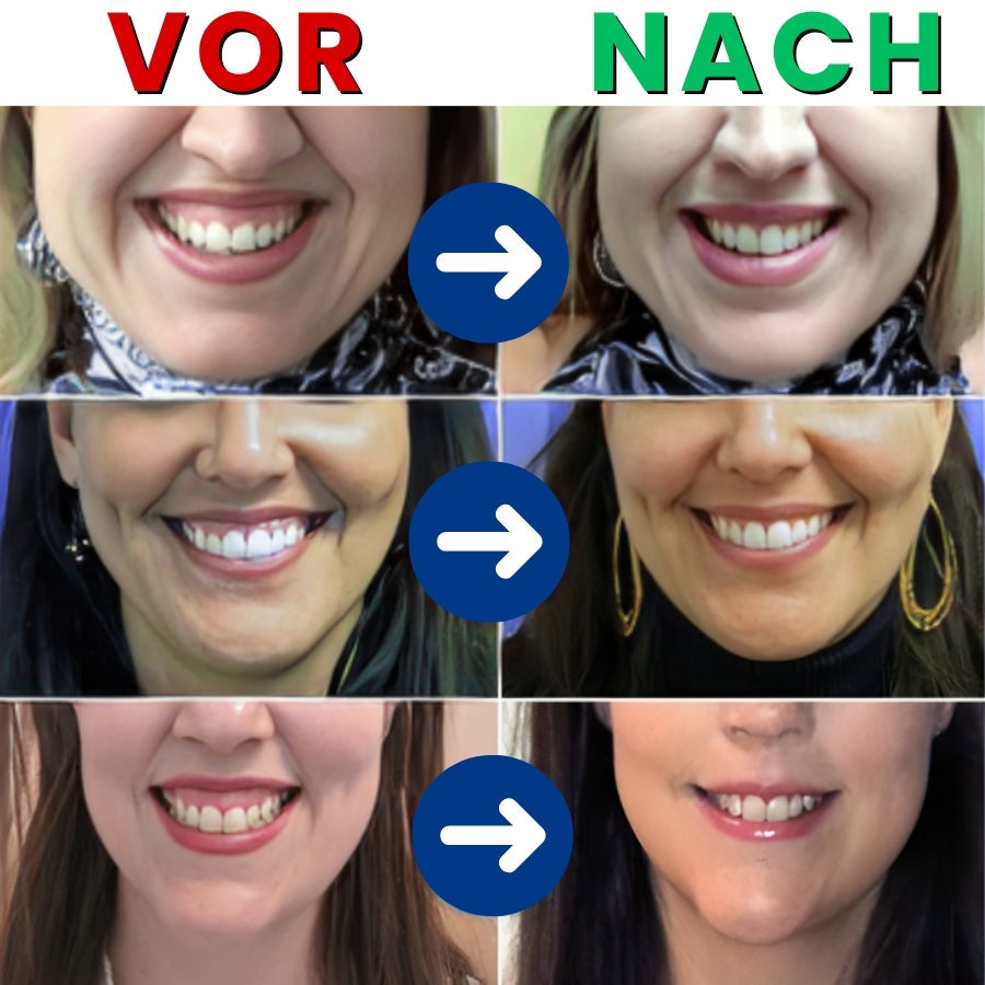 Focussmile™ | Bienengift-Behandlungspulver für den Oralgebrauch