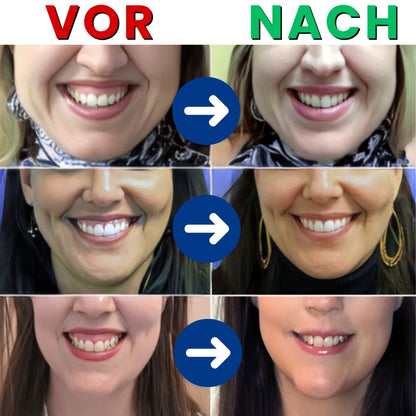 Focussmile™ | Bienengift-Behandlungspulver für den Oralgebrauch