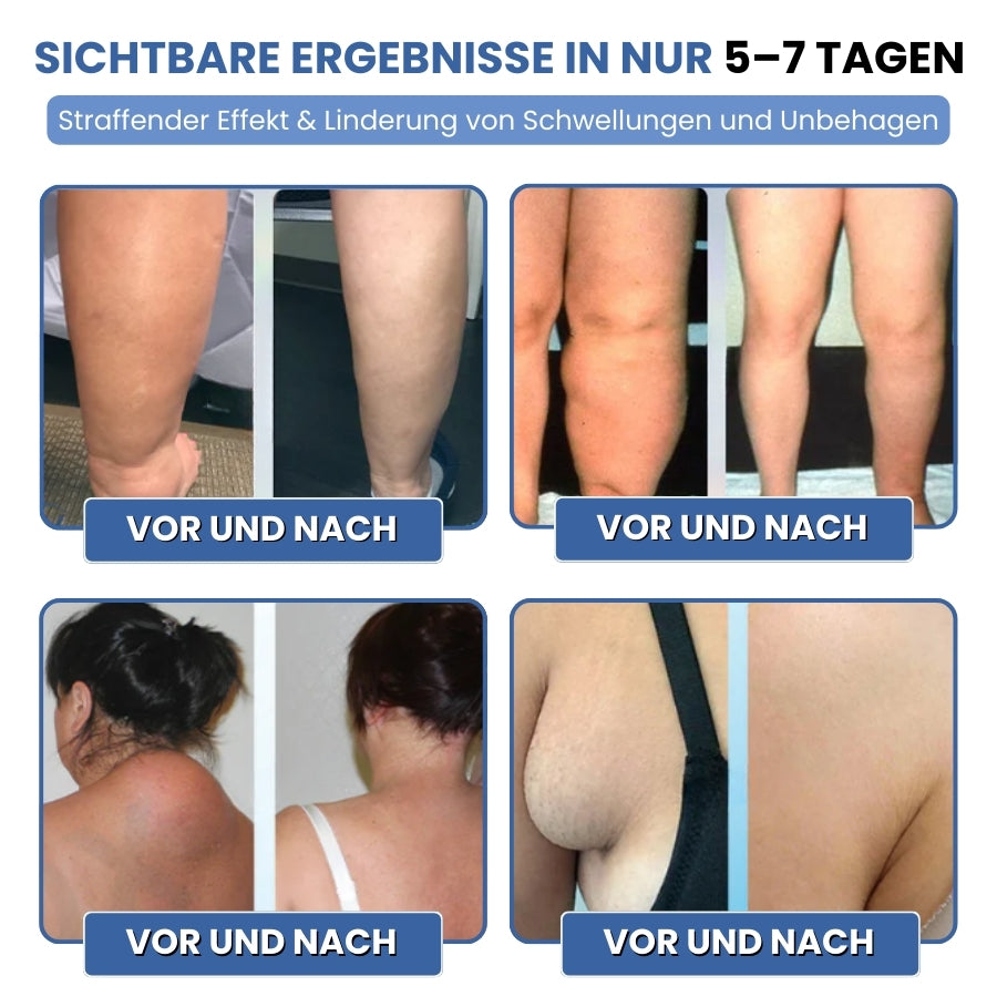 SwelEase™ | Kräutercreme zur Ödempflege