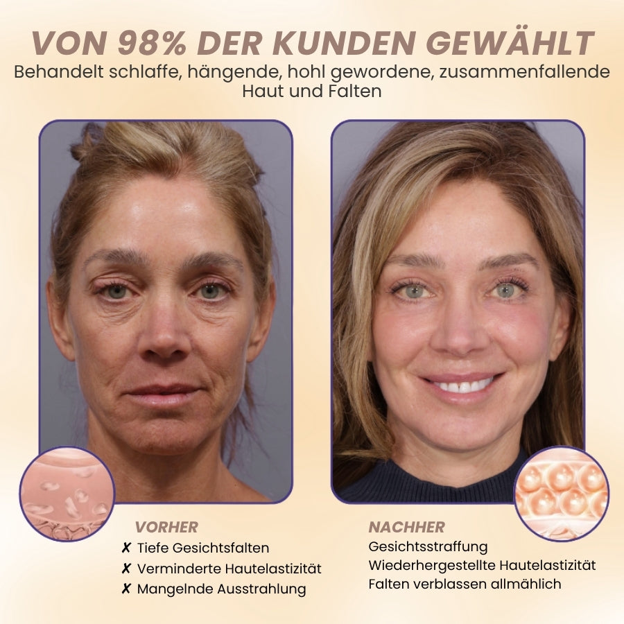 DermaPure™ | 15-Stunden-Lifting für das Gesicht