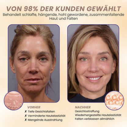 DermaPure™ | 15-Stunden-Lifting für das Gesicht